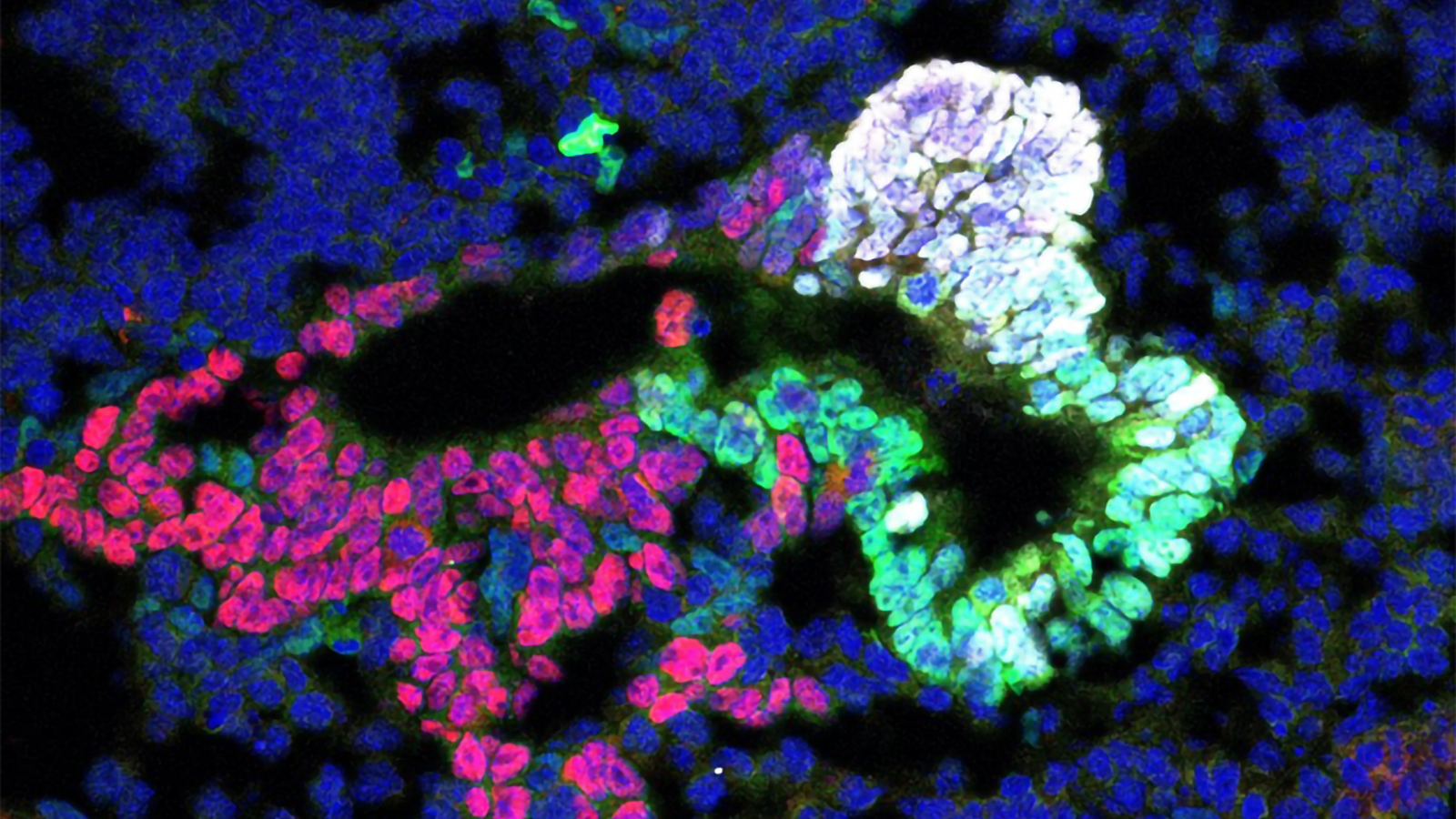 Wildtype developing ventral pancreas, gallbladder, liver, and nuclei