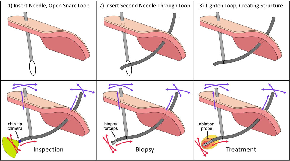 MED-Lab_Needle_1_for-web