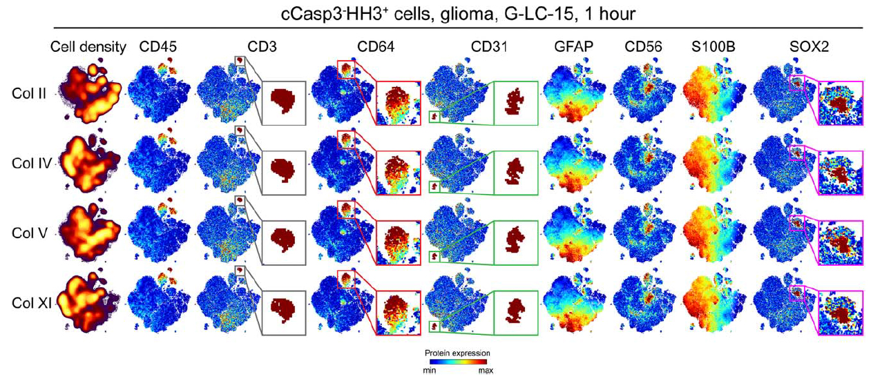 Leelatian and Doxie et al., Cytometry B 2016 Glioma Fig 4